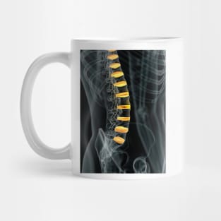 Human spinal intervertebral discs (F011/7098) Mug